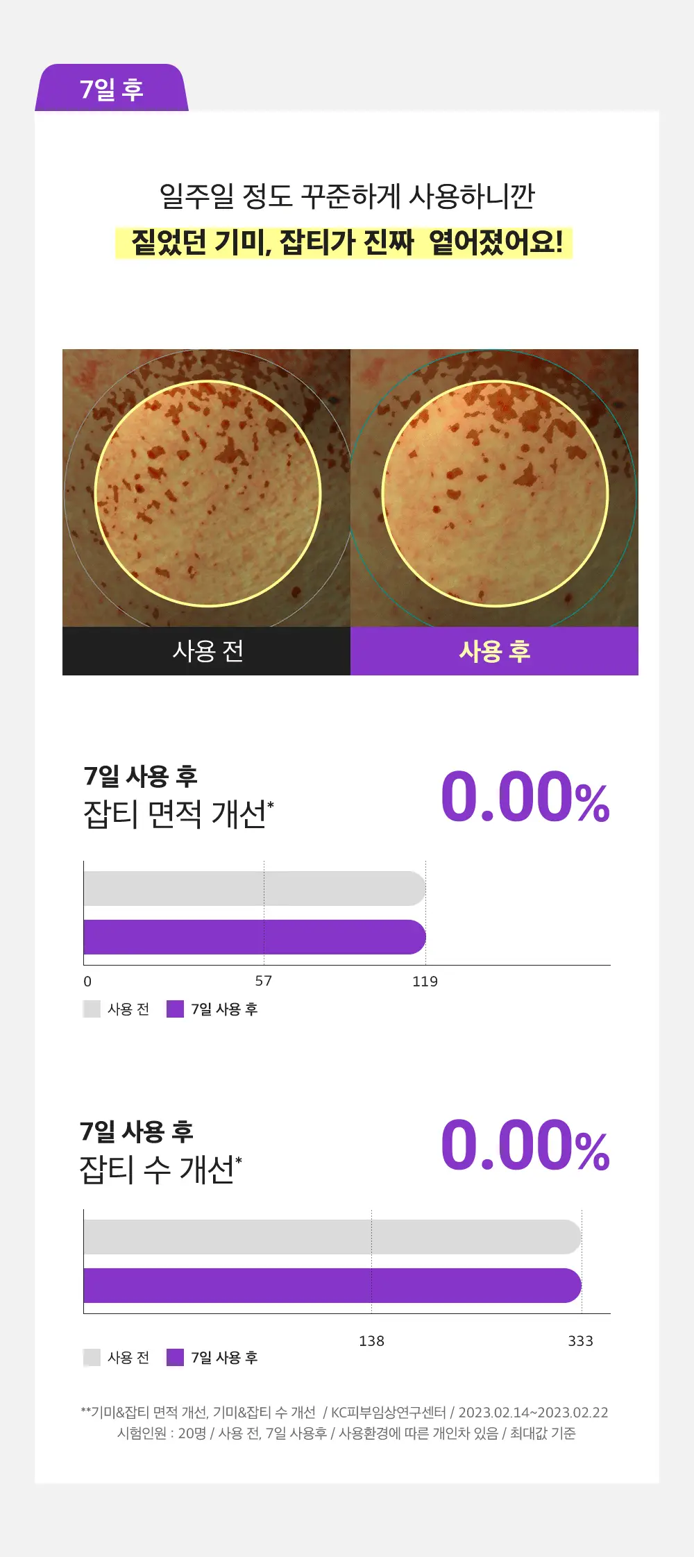 [잡티미백케어] 성분에디터 머루포도 비타씨 다크 스팟 앰플 40ml 더블기획 상세페이지 19